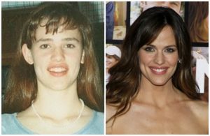 Hollywood celebrities then and now