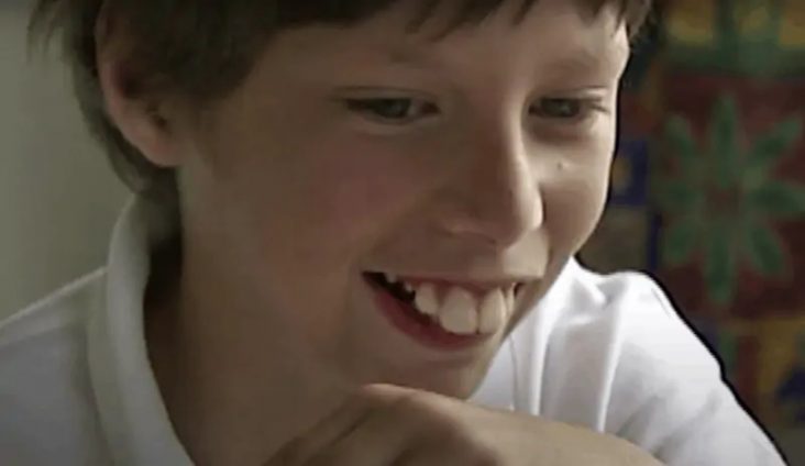 Bucktoothed “Rabbit” Boy Unbelievably Transforms. Find Out How He Looks ...